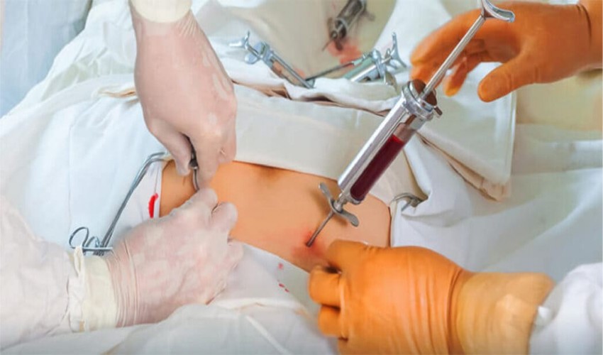 Why Bone Marrow Donation Is Simple and Crucial