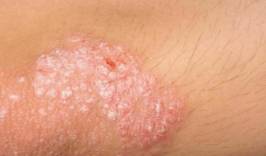 Dermatology research topic